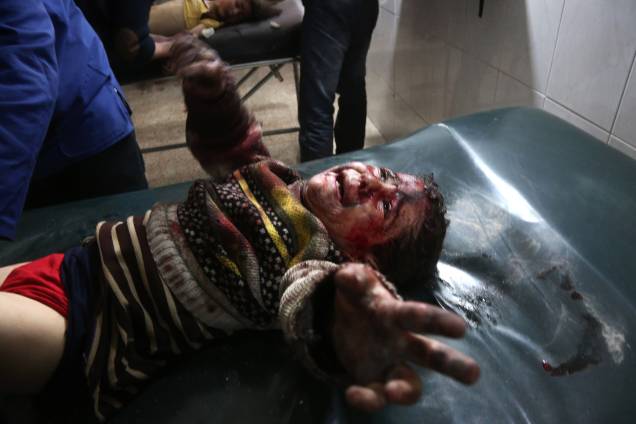 Criança síria ferida em bombardeios atribuídos às forças do governo chora enquanto recebe tratamento em um hospital na cidade rebelde de Hamouria, na região sitiada de Ghouta Oriental, nos arredores da capital, Damasco - 19/02/2018