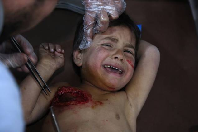 O pequeno Mohammed chora enquanto recebe tratamento em um hospital em Kafr Batna depois de ter sido ferido com sua mãe nos ataques aéreos das forças do governo na cidade de Jisreen, na região sitiada de Ghouta Oriental - 20/02/2018