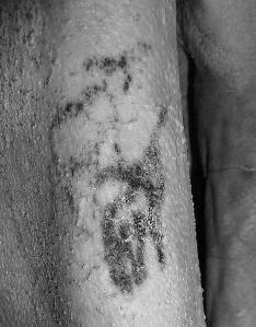 Imagem com luz infravermelha mostra detalhes de tatuagens na múmia