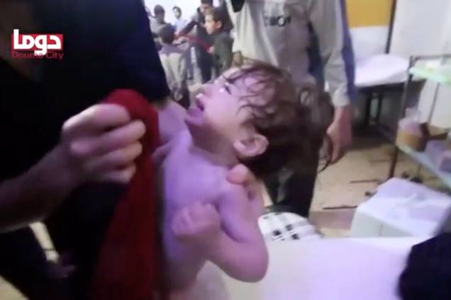 Criança chora enquanto recebe tratamento após ataque de armas químicas, em Douma, na Síria - 08/04/2018