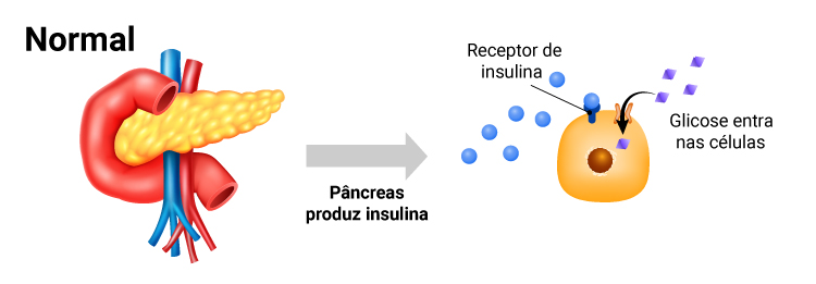 Quando os alimentos são ingeridos, o pâncreas é estimulado a produzir insulina, hormônio essencial para o metabolismo dos carboidratos. Todo carboidrato será transformado em glicose. A insulina é quem transporta a glicose pelo sangue e a carrega para dentro das células, onde será transformada em energia. A insulina funciona como uma “chave”, que abre a porta da célula para a entrada da glicose.