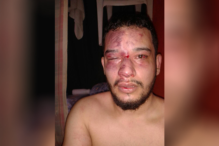 O preso político Gregory Sanabria é agredido durante motim em Caracas, na Venezuela