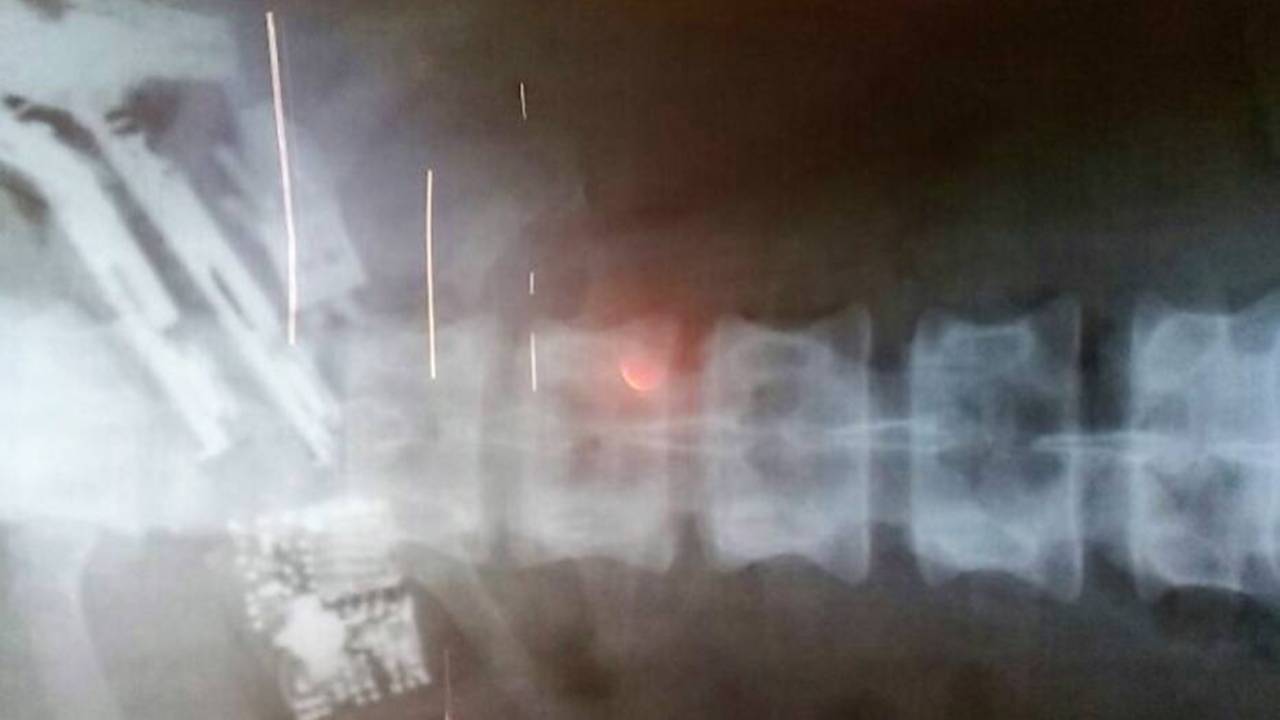 Preso engole cinco celulares