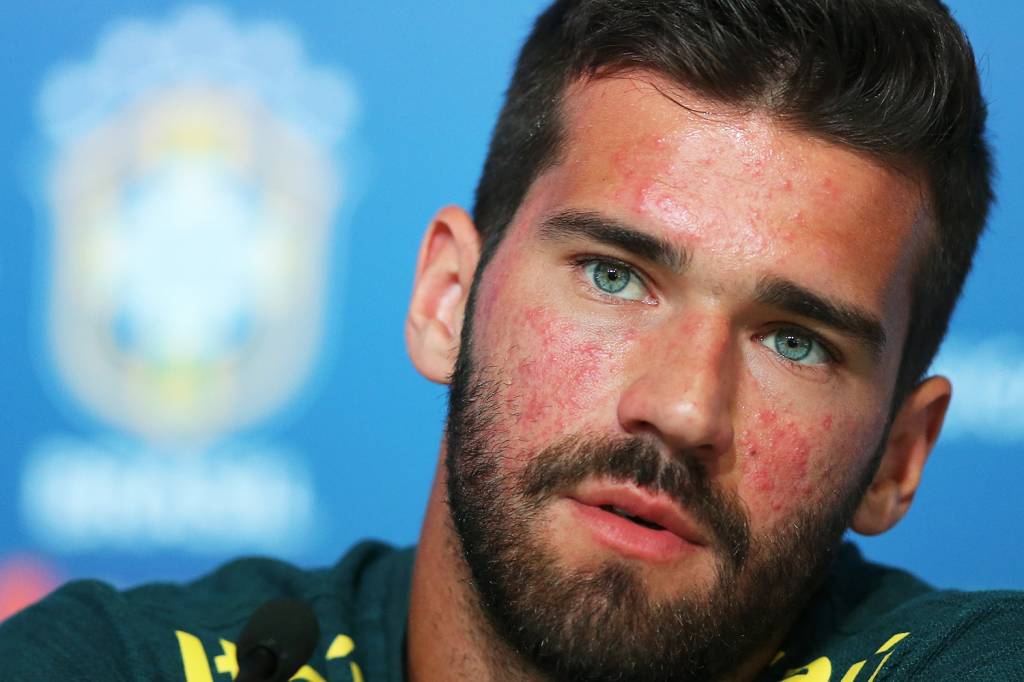 Alisson Becker: a rosácea no gol do Brasil