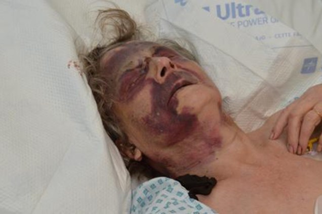 Iris Warner, 90, foi brutalmente espancada enquanto dormia em Londres