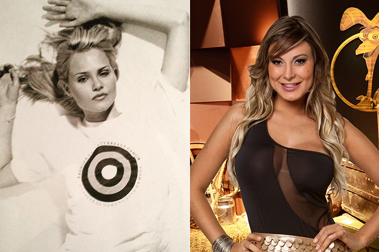 Busca por beleza a qualquer custo fez vítimas também entre celebridades