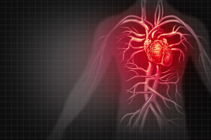 Saúde – Coração – Infarto – Doença cardiovascular