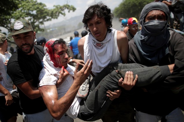 Manifestante ferido é carregado após ser atropelado por um veículo da Guarda Nacional Bolivariana nos arredores da base aérea La Carlota em Caracas, na Venezuela - 30/04/2019