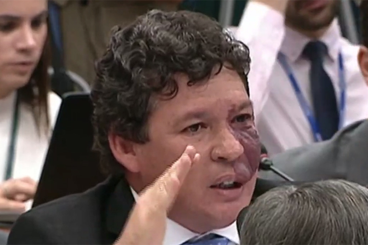 Reginaldo Lopes Reginaldo Lopes