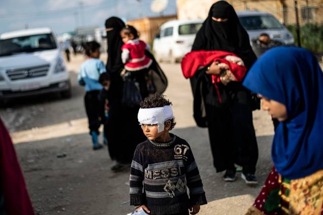 Criança ferida na cabeça caminha sozinha pelo campo de Al-Hol
