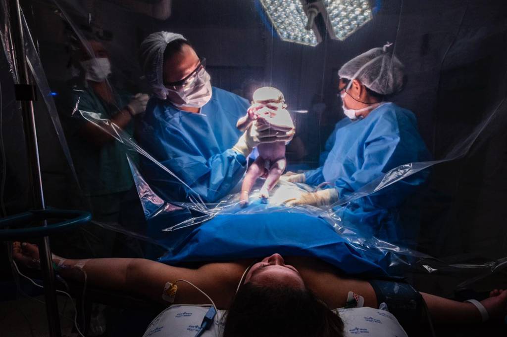 Quando a cesárea é realmente necessária, segundo a ciência