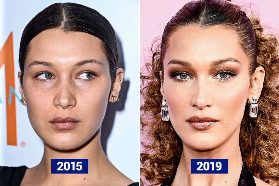 BELLA HADID, 22 ANOS - A modelo americana, que faturou 33 milhões de reais em 2018, mudou todo o rosto: afilou o nariz, preencheu a boca e levantou as sobrancelhas. A mudança mais perceptível está no formato do rosto: passou do redondo para o retangular graças às injeções de ácido hialurônico nas maçãs, nos maxilares e no queixo. Resultado: bastante visível