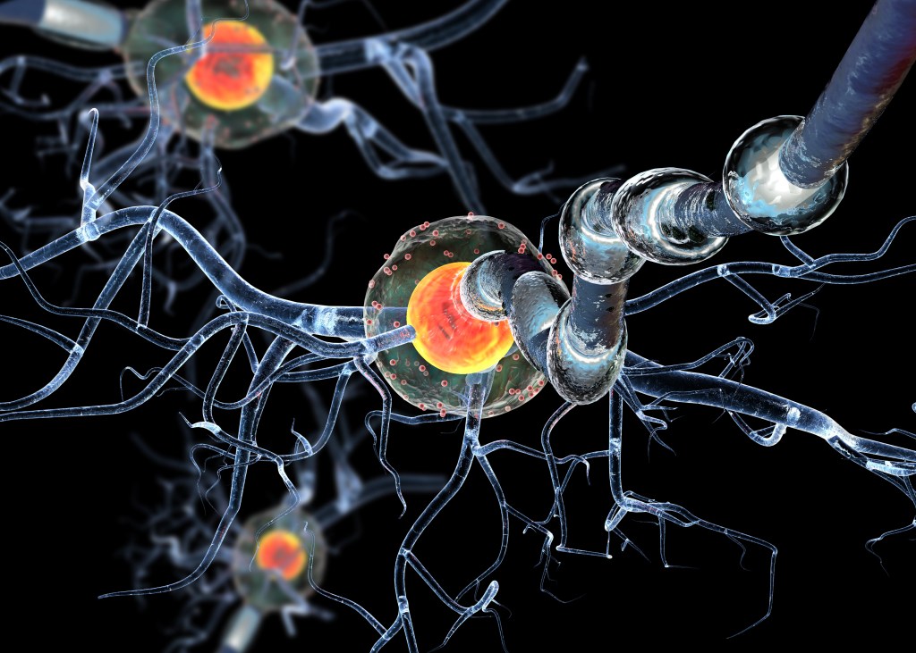 High quality 3d render of nerve cells,isolated on black background, concept for Neurologic Diseases, tumors and brain surgery.