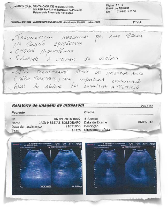 RISCO DE MORTE – Os laudos médicos que constam da investigação da Polícia Federal: as lesões foram gravíssimas RISCO DE MORTE – Os laudos médicos que constam da investigação da Polícia Federal: as lesões foram gravíssimas