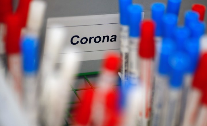 Testes COVID-19 em SP: Exames para coronavírus