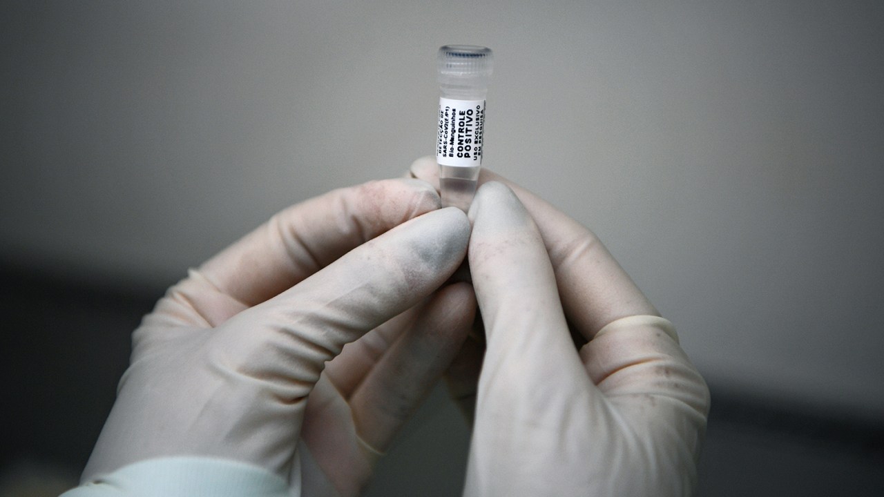 Um analista do laboratório Fiocruz, instituto de pesquisa em saúde pública, no Rio de Janeiro, com uma amostra de muco a ser testado para o COVID-19