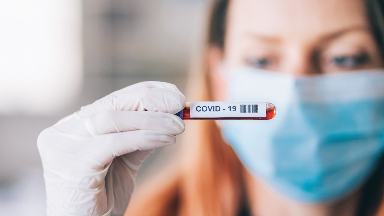 Coronavirus Blood Sample
