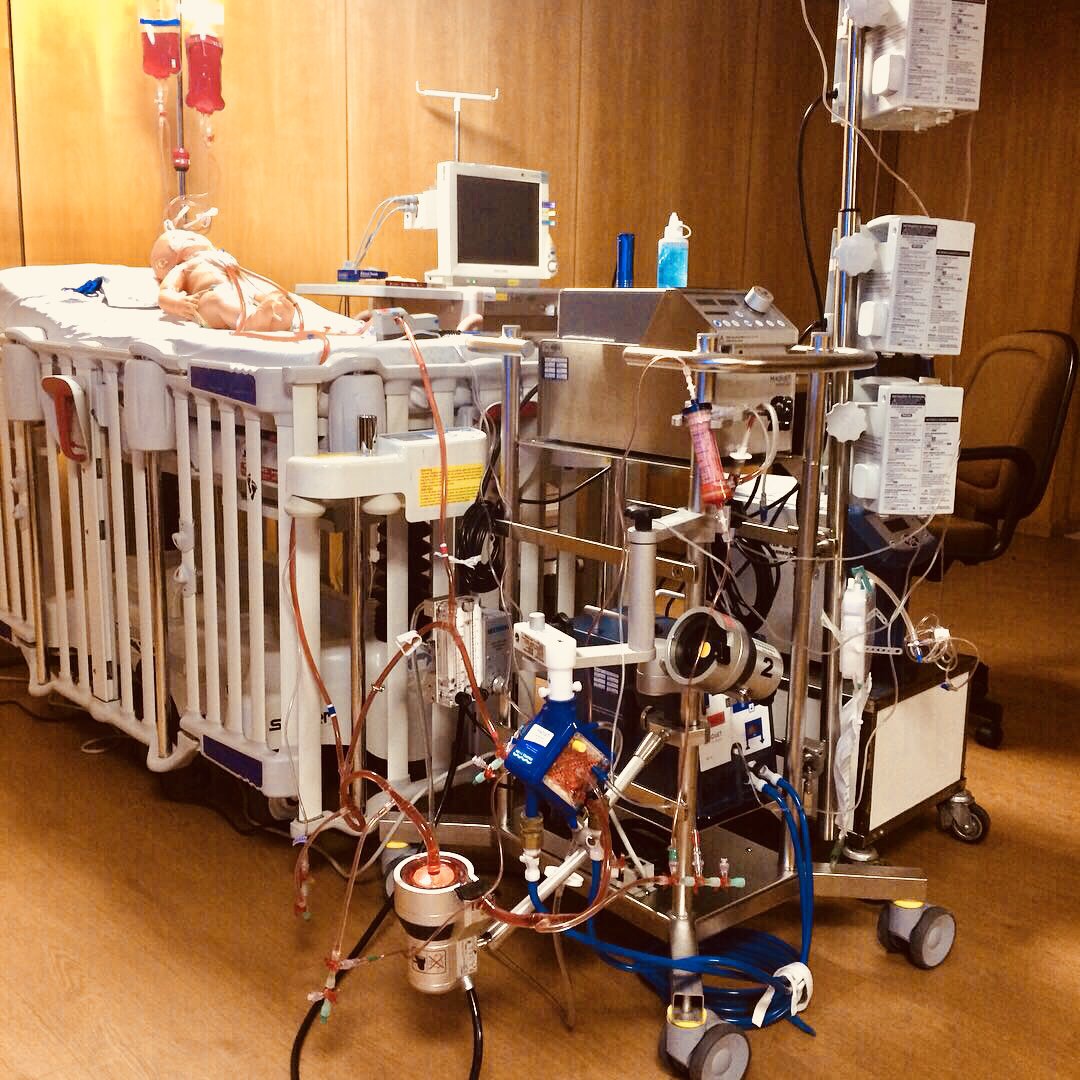 ECMO