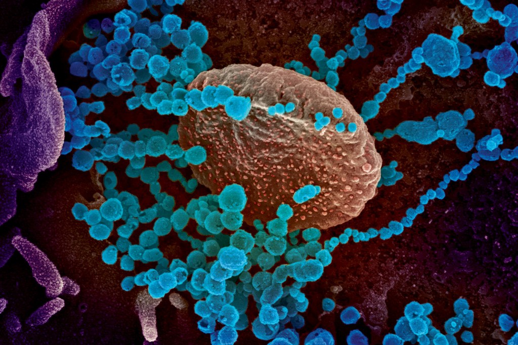 A HORA H - O SARS-CoV-2 entrando na célula: semelhanças na infecção com o HIV -