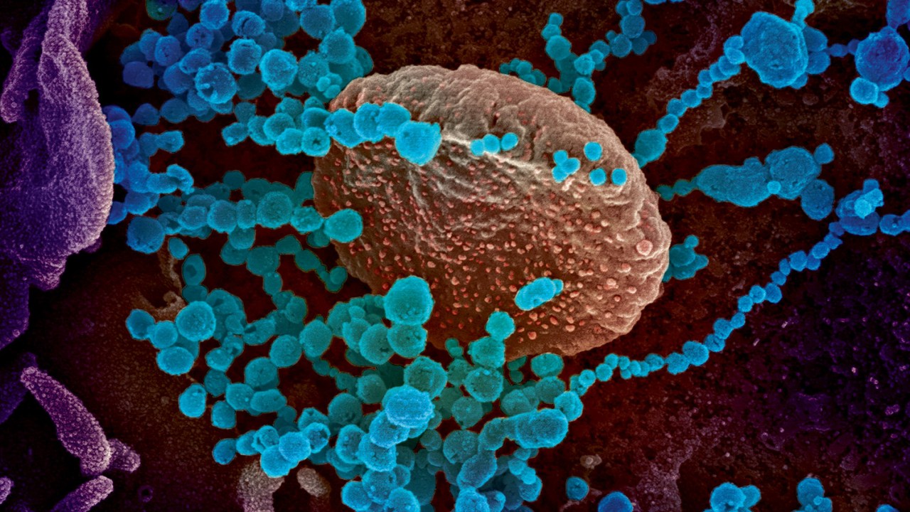 A HORA H - O SARS-CoV-2 entrando na célula: semelhanças na infecção com o HIV -
