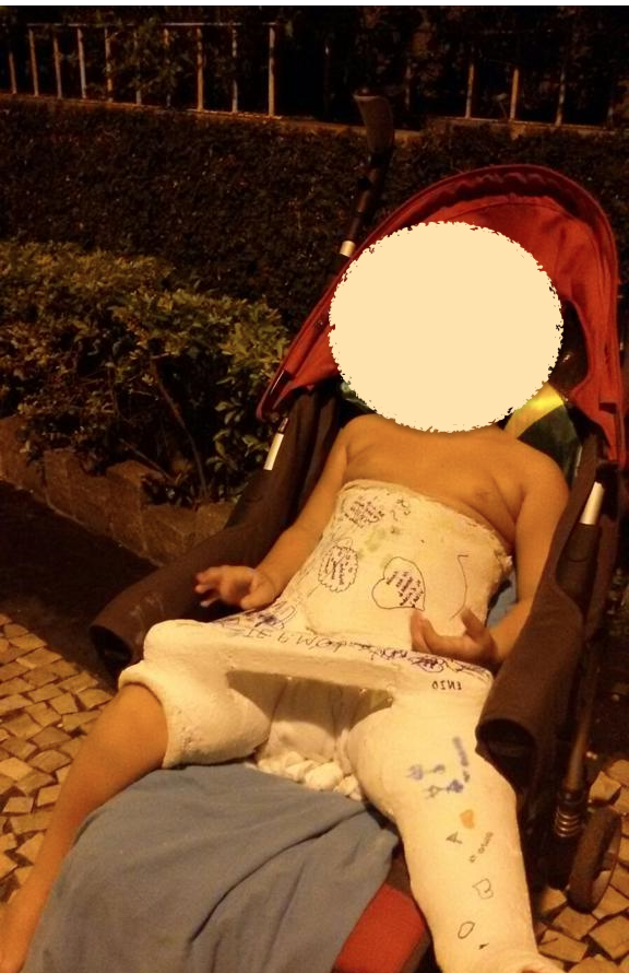 Foto do menino, à época com três anos, com a perna quebrada após passeio com Jairinho