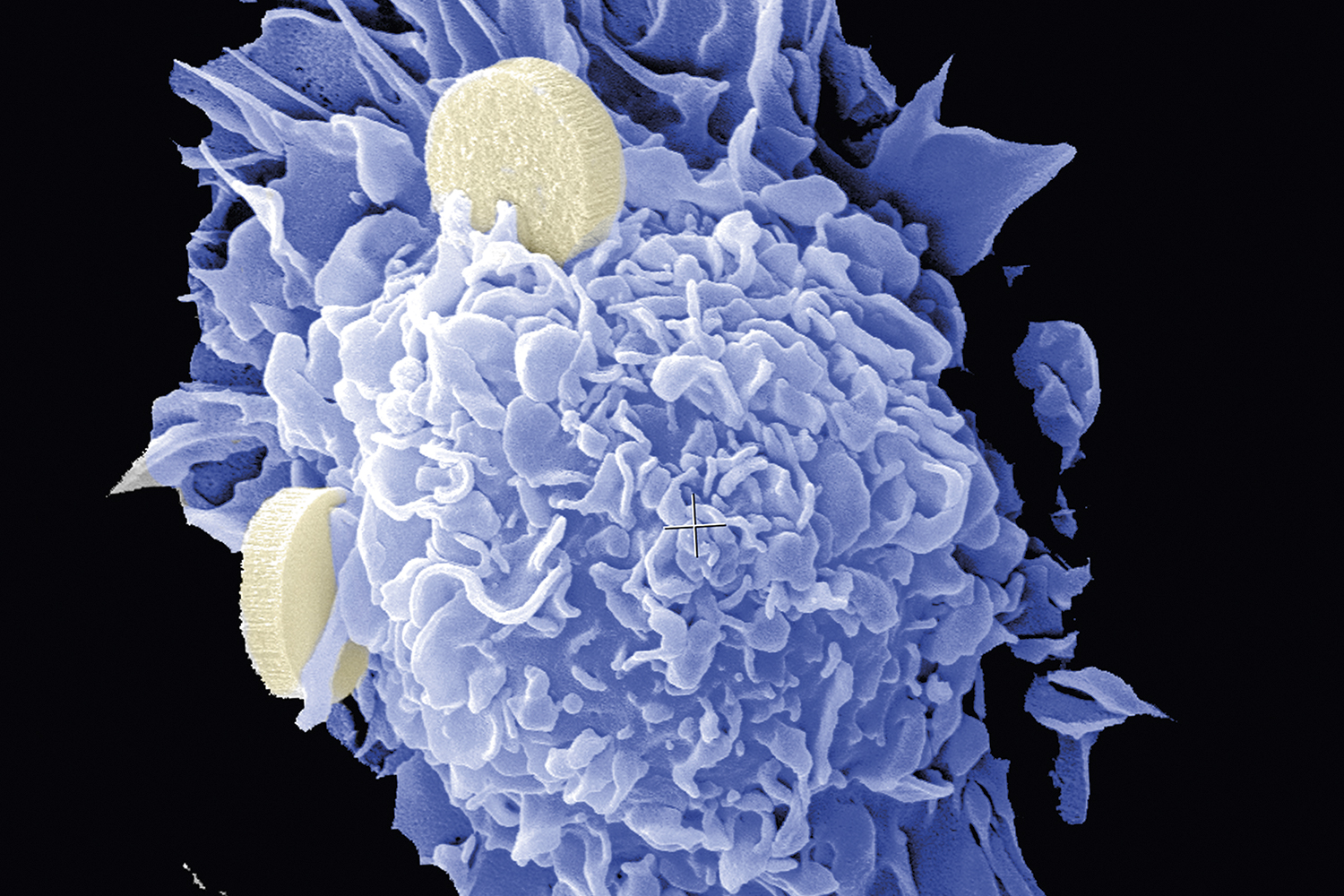 AÇÃO - Nanovacina (em azul): o antígeno estimula uma resposta do organismo -