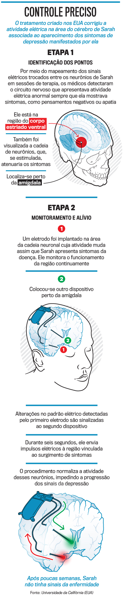 Sintomas da Depressão