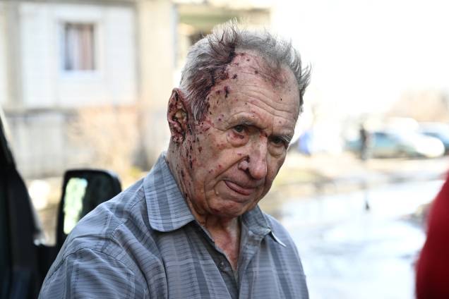 Homem ferido recebendo assistência médica após bombardeios na cidade de Chuguiv, no leste da Ucrânia -