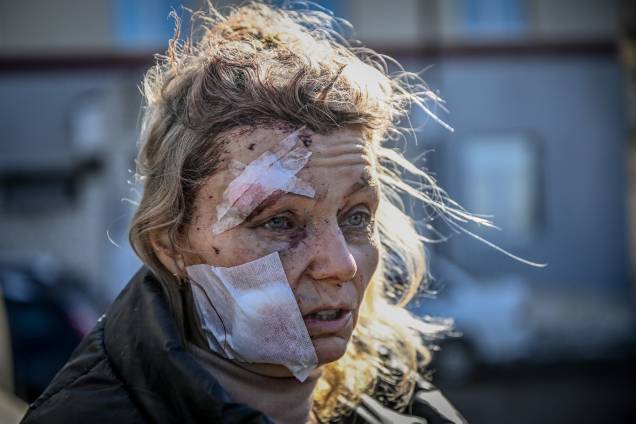 Mulher ferida após um bombardeio da cidade de Chuguiv, no leste da Ucrânia -