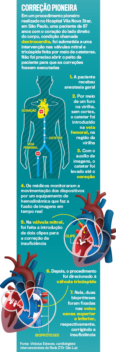 CIRURGIA NO CORAÇÃO - OPERATE NOW 