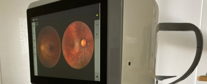 pesquisadores da empresa Eyetec conseguiram reduzir drasticamente a quantidade de componentes necessários para fabricação do equipamento