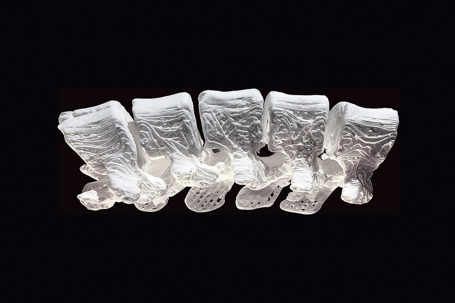ENCAIXA TOTAL - Vértebras artificiais: precisão garantida por impressoras 3D -
