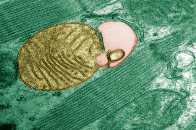 Mitocôndria sendo envolvida pelo autofagossomo