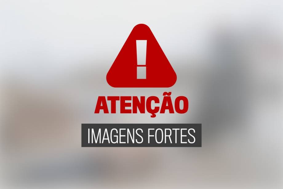 ATENÇÃO - A galeria a seguir contêm imagens fortes -