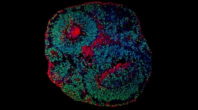 Pesquisadores usaram organoides cerebrais, aglomerado de células humanas que cresce no laboratório e se assemelha a uma miniatura de cérebro em desenvolvimento