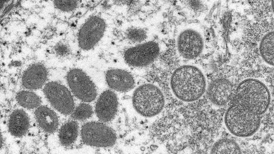 1º caso de varíola dos macacos da Alemanha é confirmado em brasileiro | VEJA