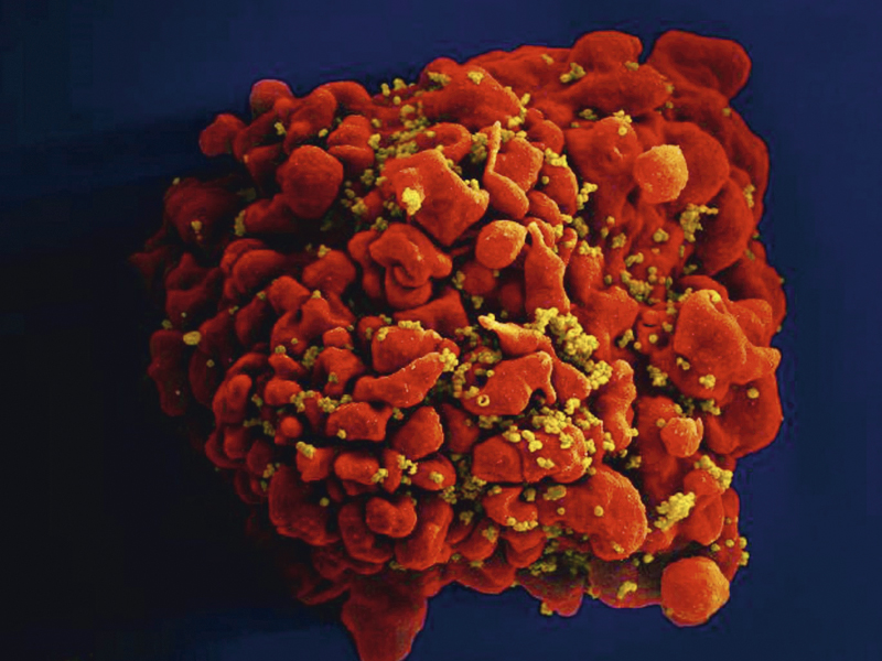 ATAQUE - Célula infectada por HIV: danos ao material genético -