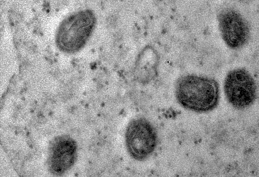 A partir dos registros, estima-se que o vírus monkeypox meça 300 nanômetros, em média -
