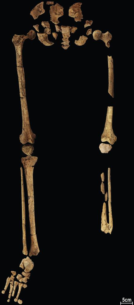 Parte do esqueleto de 31 mil anos encontrado em Bornéu mostra sinais de amputação do membro esquerdo -