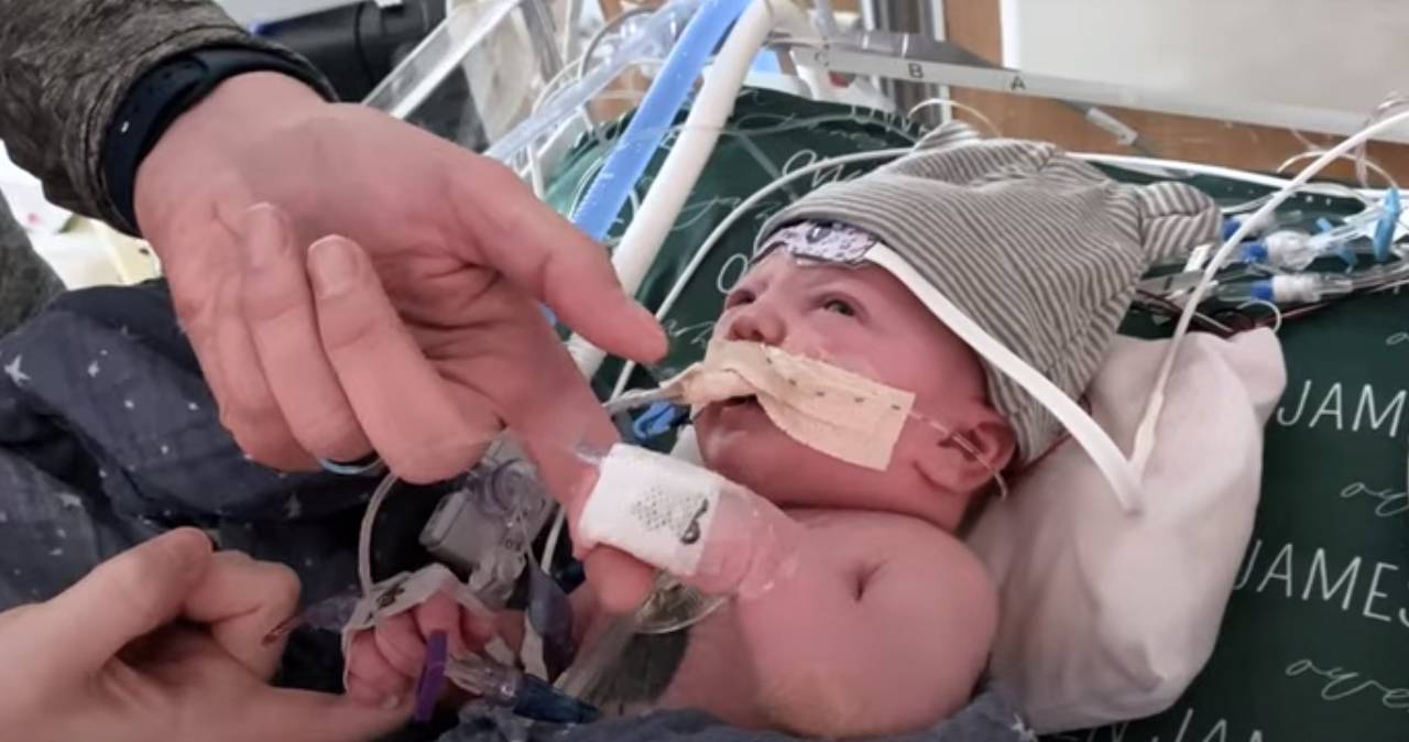 Procedimento foi realizado no bebê Owen em abril no hospital Duke Health