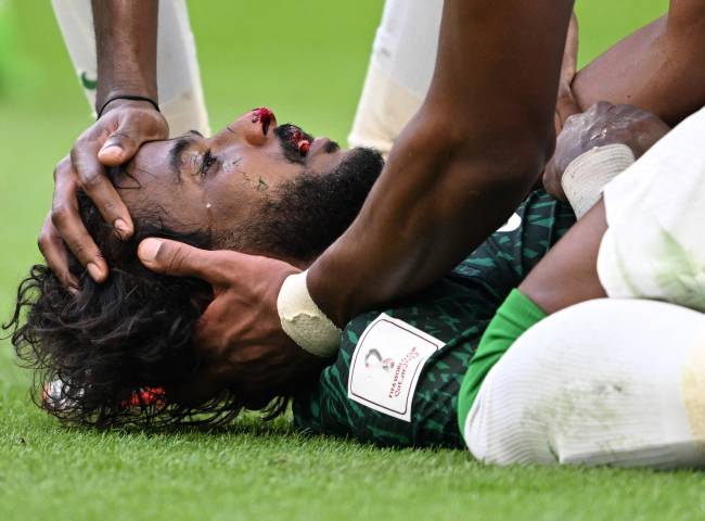 Al-Shahrani ficou desacordado em campo -