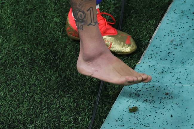 Picture of the swollen ankle of Brazil's forward #10 Neymar taken as he leaves the field at the end of the Qatar 2022 World Cup Group G football match between Brazil and Serbia at the Lusail Stadium in Lusail, north of Doha on November 24, 2022. (Photo by Giuseppe CACACE / AFP)