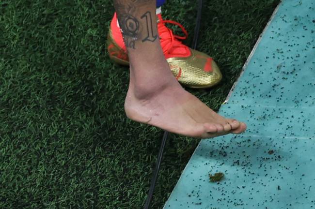 FBL-WC-2022-MATCH16-BRA-SRB Picture of the swollen ankle of Brazil's forward #10 Neymar taken as he leaves the field at the end of the Qatar 2022 World Cup Group G football match between Brazil and Serbia at the Lusail Stadium in Lusail, north of Doha on November 24, 2022. (Photo by Giuseppe CACACE / AFP)