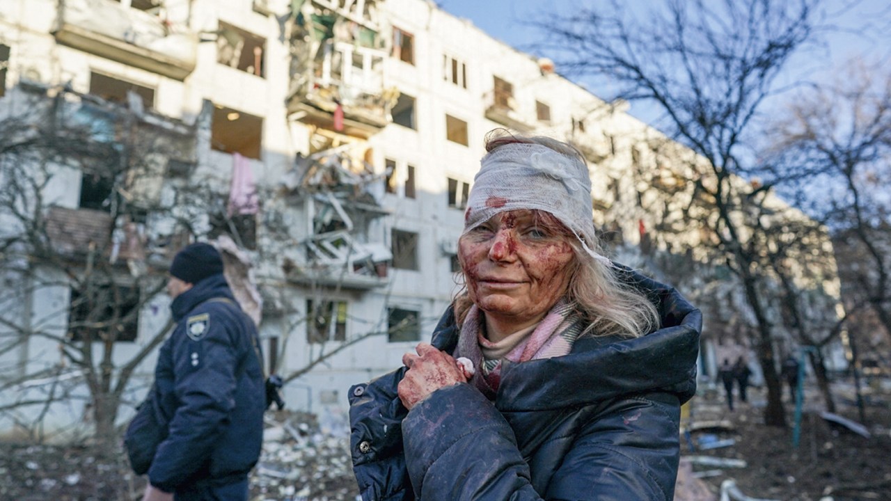 DESTRUIÇÃO - Bombardeio russo: drama humanitário na guerra sem fim -