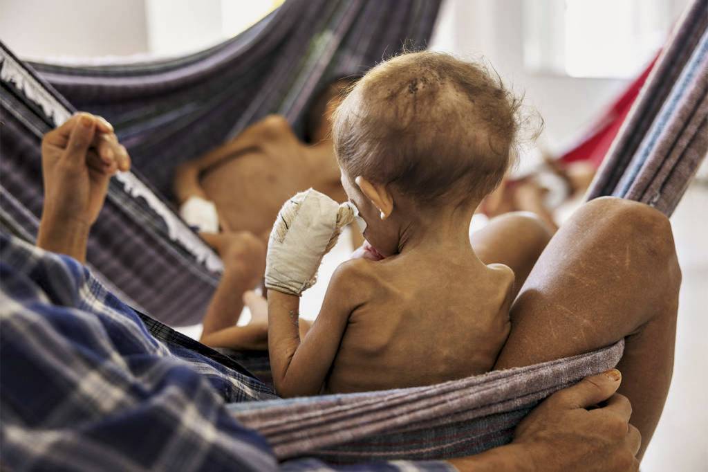 DRAMA - Crianças em UTI de Boa Vista: 570 mortes em quatro anos -