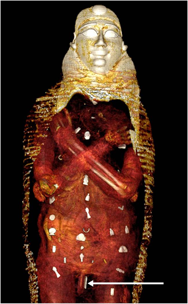 Imagem mostra a localização dos amuletos encontrados na múmia -