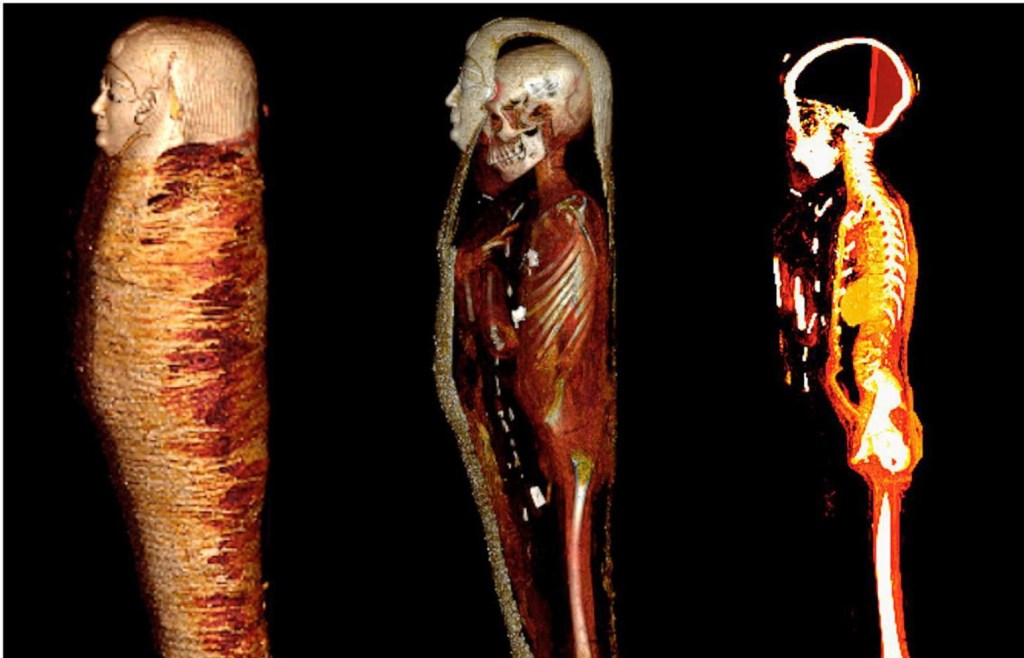 Detalhe da imagem computadorizada da múmia -