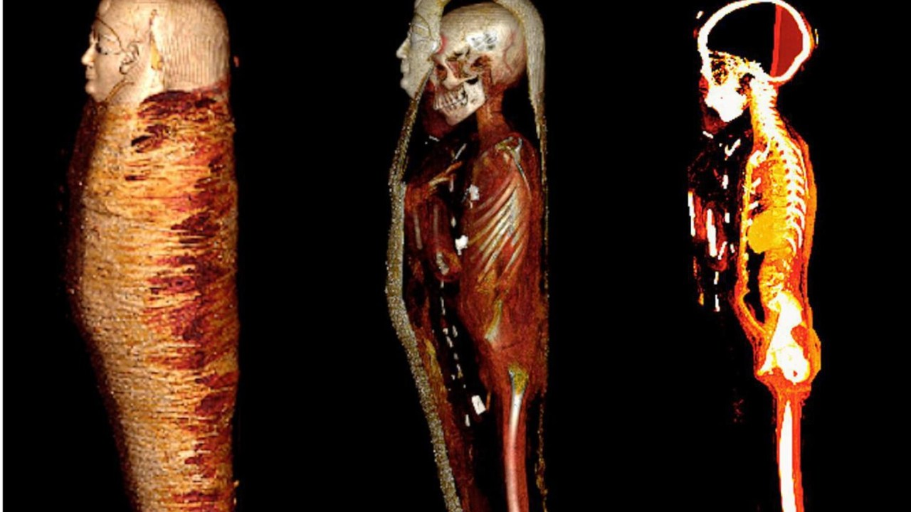 Detalhe da imagem computadorizada da múmia -