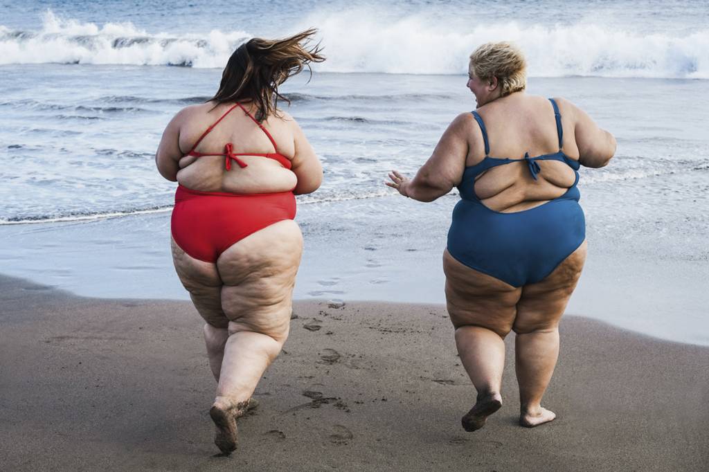 LONGO PRAZO - Adultos obesos: 80% já sofriam da doença mais novos