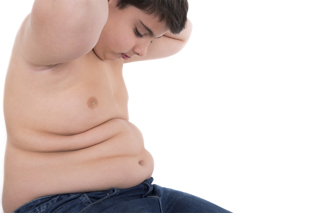 UM MAL GLOBAL - A obesidade na infância avança: maus hábitos são um motor